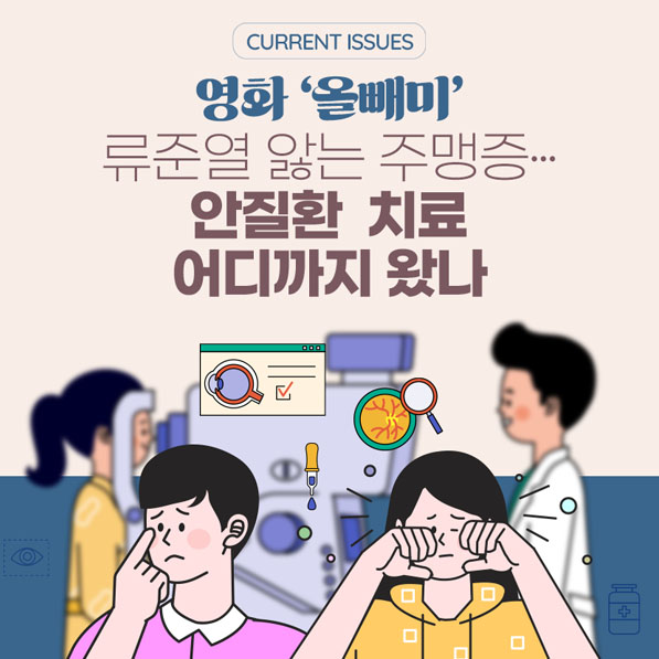 영화 ‘올빼미’ 류준열 앓는 주맹증... 안질환 치료 어디까지 왔나